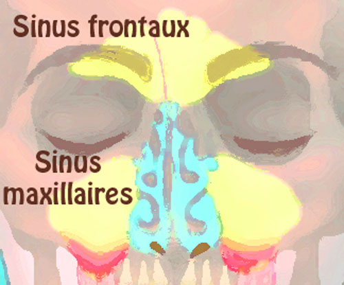 Sinusite: maîtriser les symptômes